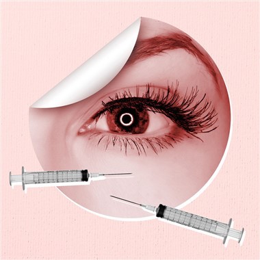 خطوط ریز دور چشم را از بین ببرید