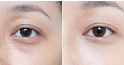 2672869378e95ba446022fb2da9eb5ae 2672869378e95ba446022fb2da9eb5ae